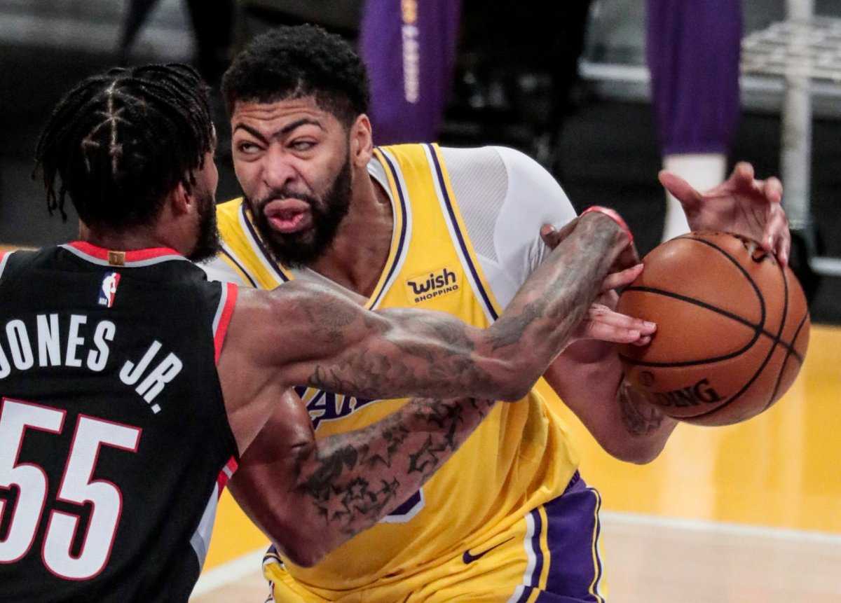 Les dents mal alignées d'Anthony Davis l'ont-elles aidé à obtenir des conseils de Kobe Bryant des Lakers?