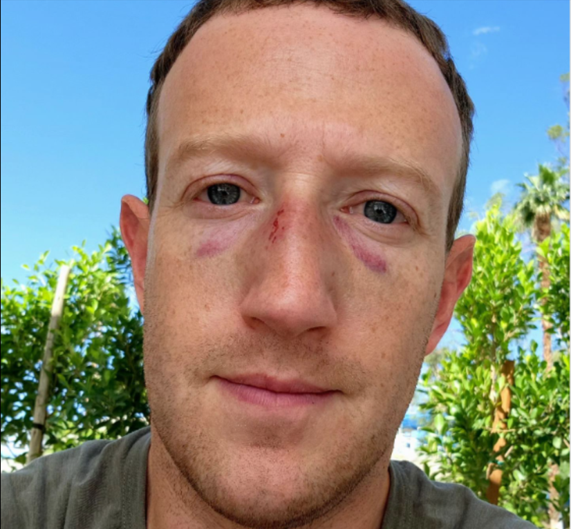 « Ils vous ont battu Facebook » : le PDG de Meta, Mark Zuckerberg, montrant sa blessure après une séance d'entraînement envoie les fans dans la frénésie